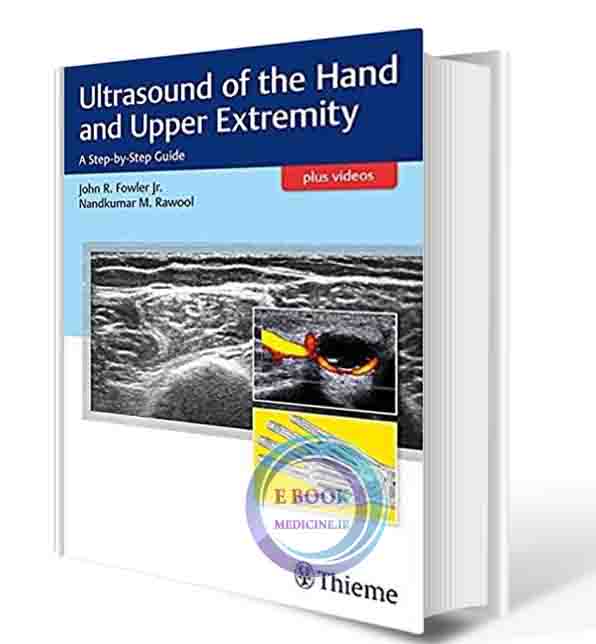 دانلود کتاب Ultrasound of the Hand and Upper Extremity: A Step-by-Step Guide 1st 2017 (ORIGINAL PDF)